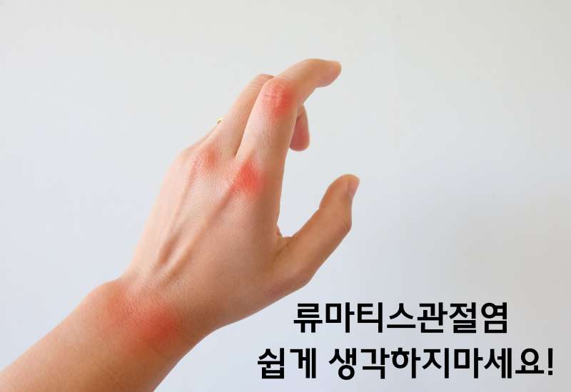 류마티스 관절염 쉽게 생각하지 마세요