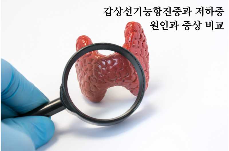 갑상선항진증과 저하증