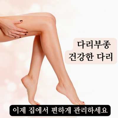 다리부종 집에서 관리하세요