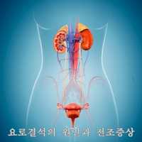 요로결석의 원인과 전조증상