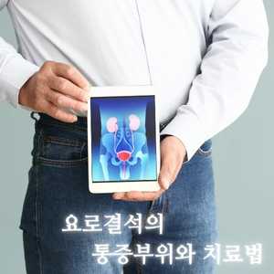 요로결석 통증부위와 치료법